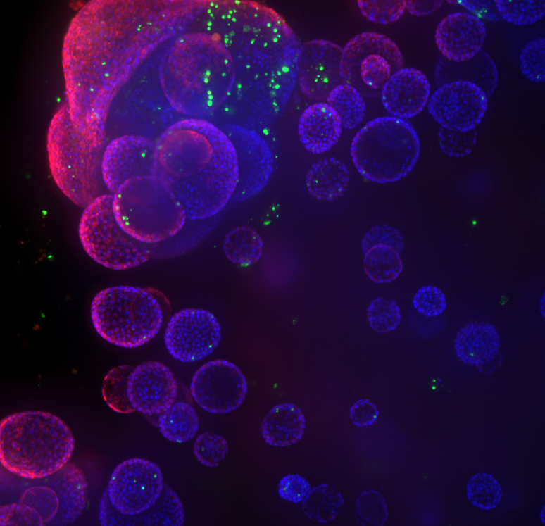 3D spheroids and organoids image 3D spheroids and organoids image