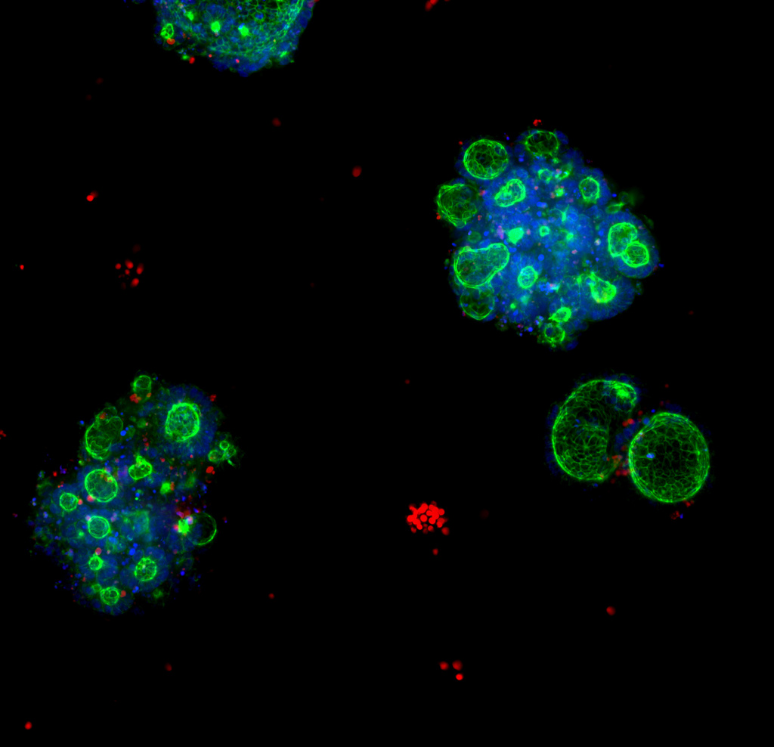 3D spheroids and organoids image 3D spheroids and organoids image