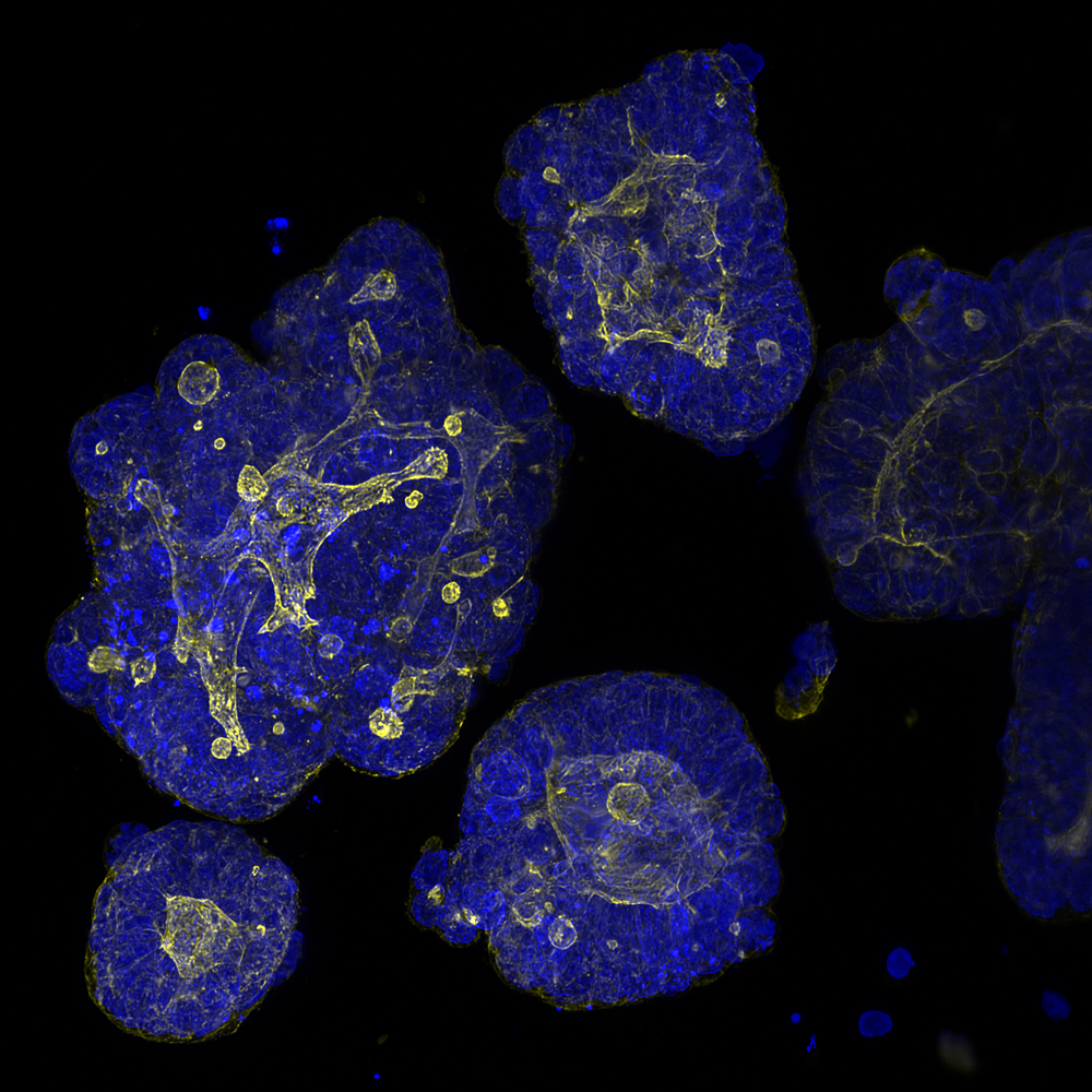 Organoid-NPL._RGB_XYMIP_crop_1000x1000 Organoid-NPL._RGB_XYMIP_crop_1000x1000